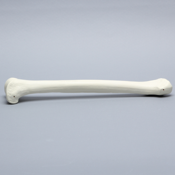 Femur with Broached Proximal Cavity