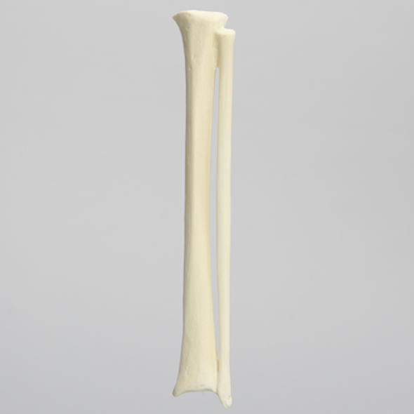 Tibia Fibula Combination