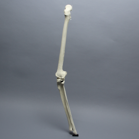 Knee with Fibula and Three Stretch Cord Ligaments, Full Length, Arthritic