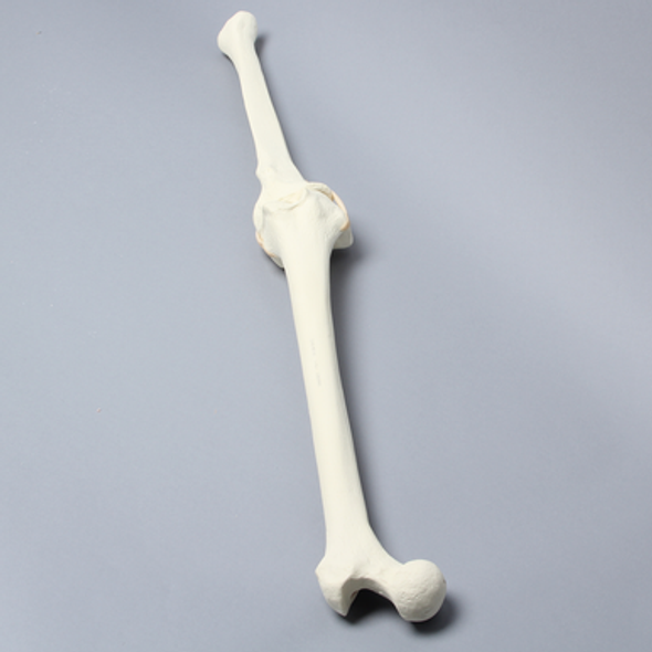 Knee with Three Stretch Tube Ligaments, Full Length, Arthritic