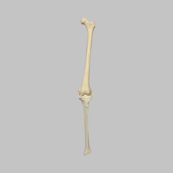 Knee with Three Stretch Tube Ligaments, Full Length, Arthritic