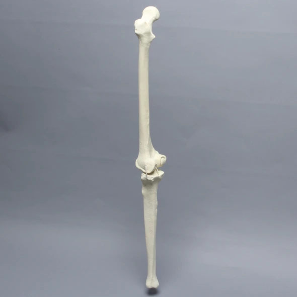 Knee with Four Non-Stretch Ligaments, Full Length, Arthritic