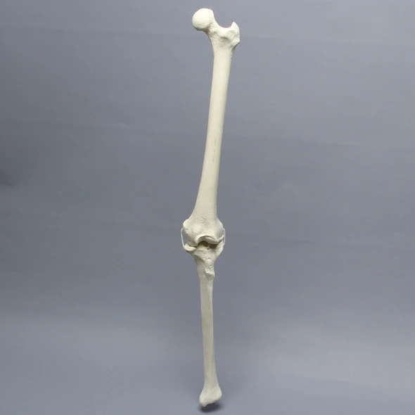 Knee with Four Non-Stretch Ligaments, Full Length, Arthritic