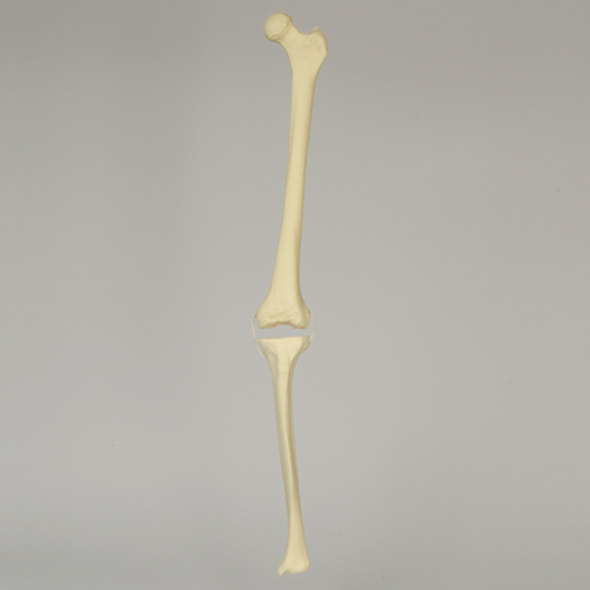Knee with Revision Cuts and Stretch Cord Collateral Ligaments, Full Length