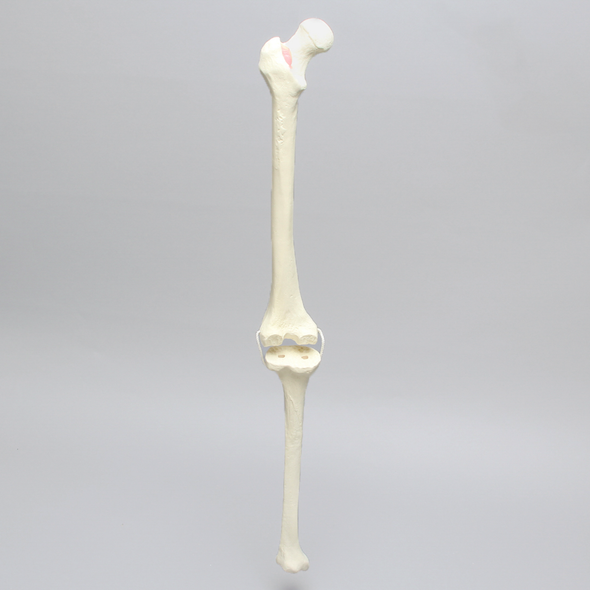 Knee with Revision Cuts and Non-Stretch Collateral Ligaments, Full Length