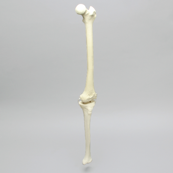 Knee with Revision Cuts and Non-Stretch Collateral Ligaments, Full Length