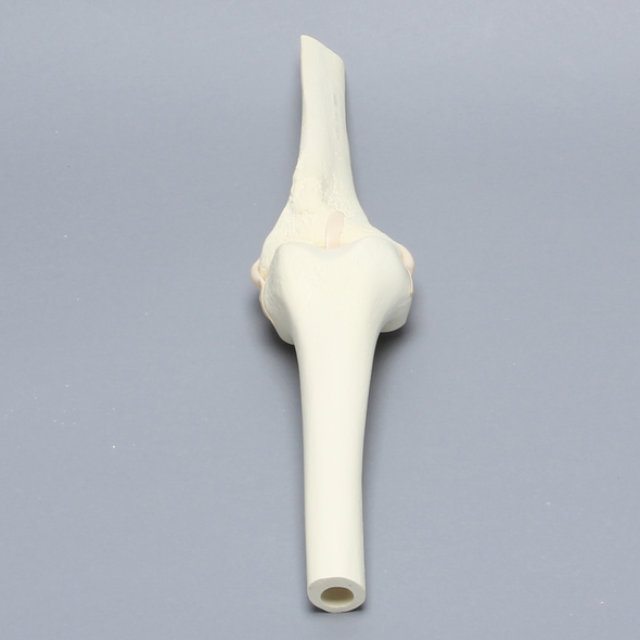 Knee Joint with Narrow Intercondylar Notch and Four Stretch Tube Ligaments