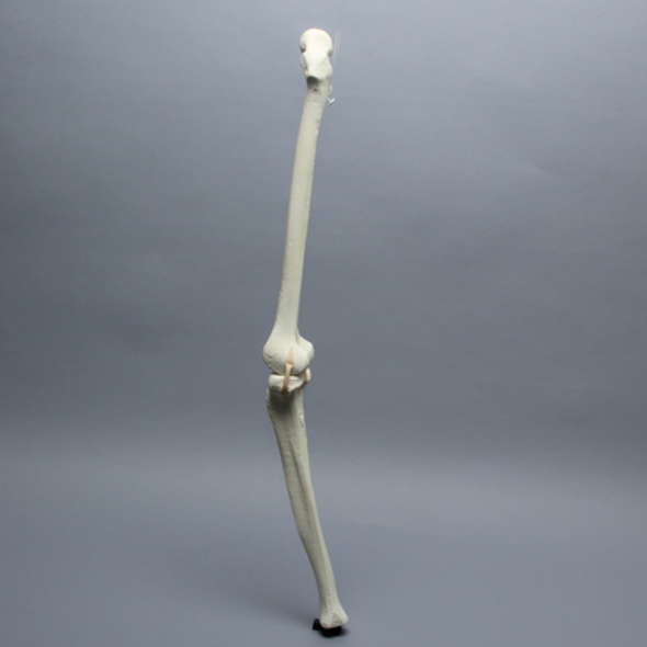 Knee with Three Stretch Tube Ligaments and Thicker Cortex, Full Length