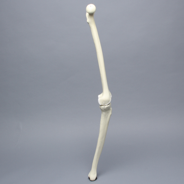 Knee with Erosion and Three Stretch Cord Ligaments, Full Length