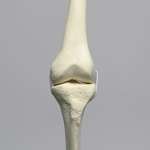 Knee with Three Stretch Cord Ligaments and Narrow Intercondylar Notch, Full Length