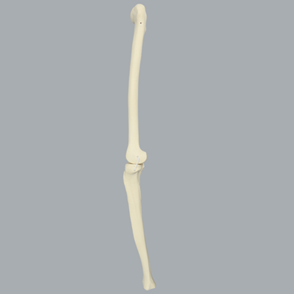 Knee with Three Nylon Non-Stretch Ligaments and Narrow Intercondylar Notch, Full Length