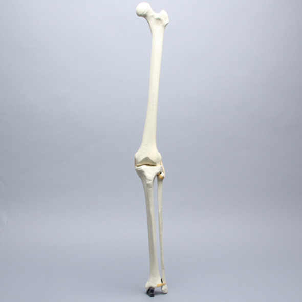 Knee with Fibula, Narrow Intercondylar Notch, Modified Plateau, and Three Stretch Tube Ligaments
