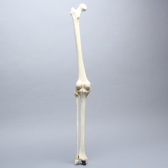 Knee with Fibula, Narrow Intercondylar Notch, Modified Plateau, and Three Stretch Tube Ligaments