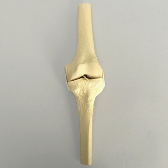 Knee with Four Stretch Cord Ligaments, Half Length