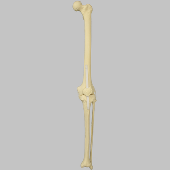 Knee with Fibula, Patella, and Four Ligaments, Full Length
