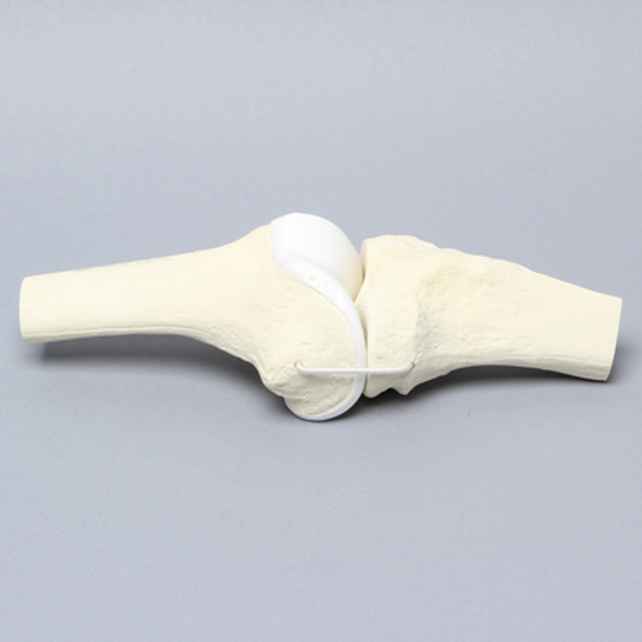 Knee Joint with Articular Cartilage