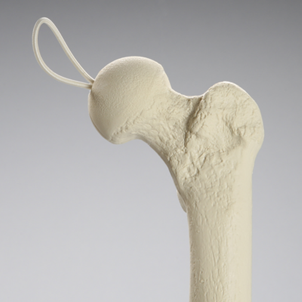 Knee Replacement with Tibia and Femur for #1301-169 and 1301-169-1