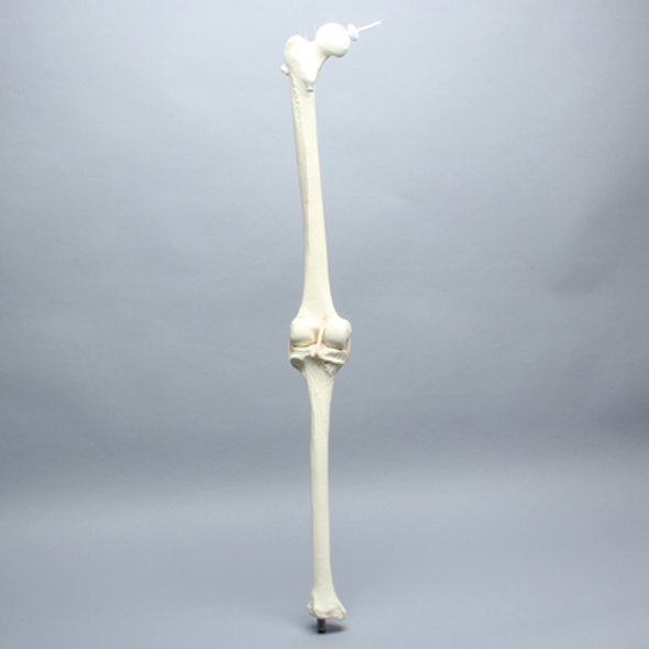 Knee Replacement for Hip Assembly #1301-161