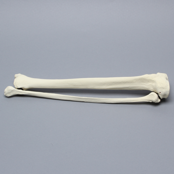 Tibia and Fibula, Left, Large