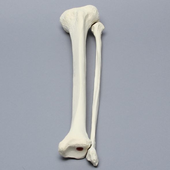 Tibia and Fibula, Left, Large