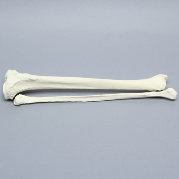 Tibia and Fibula, Right, Large