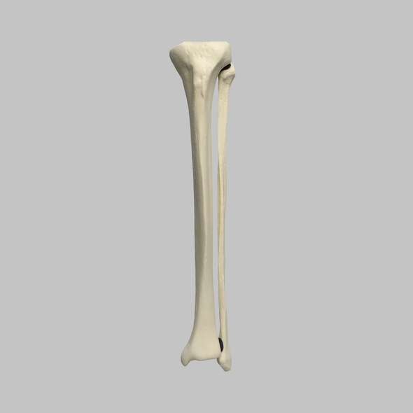 Tibia and Fibula, Foam Cortical, Left Tibia and Fibula, Foam Cortical, Left