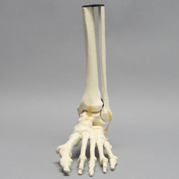 Foot and Ankle with Hammertoes, Bunions, and Heel Spur