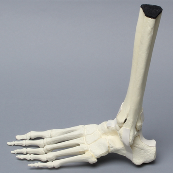 Foot and Ankle with Non-Stretch Ligaments