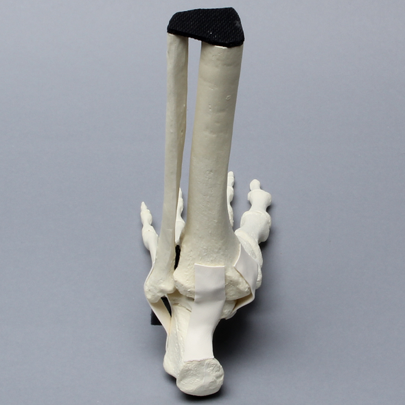 Foot and Ankle with Non-Stretch Ligaments