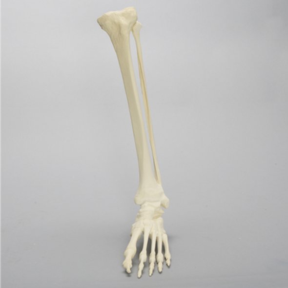 Foot and Ankle with Multiple Deformities