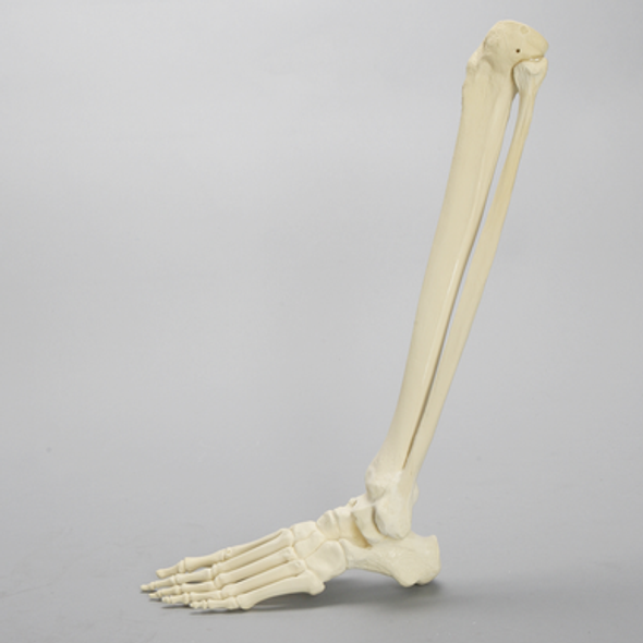 Foot and Ankle with Multiple Deformities