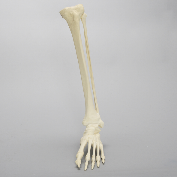 Foot and Ankle with Multiple Deformities