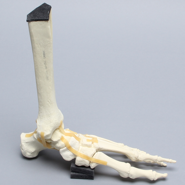 Foot and Ankle with Lisfranc and Cuboid Fractures