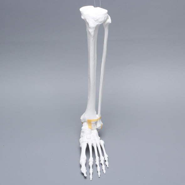 Foot and Ankle, Plastic Cortical, Left