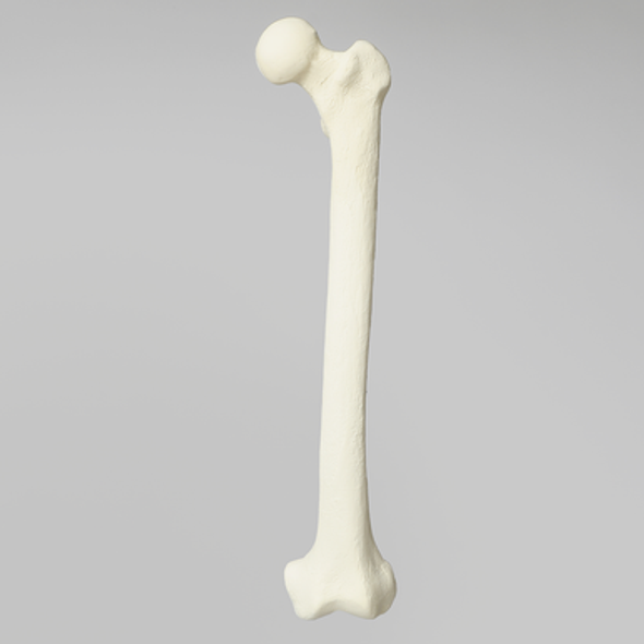 Femur with 12 mm Canal and Distal Plug