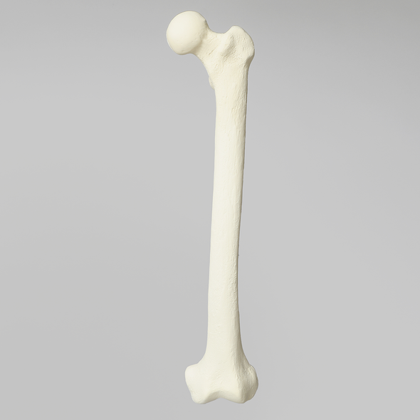 Femur with 12 mm Canal and Distal Plug