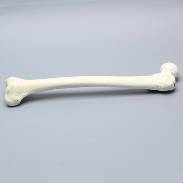 Femur with 17 mm Trochanteric Entry Site For IM Nail