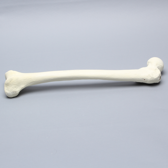 Femur with 17 mm Trochanteric Entry Site For IM Nail