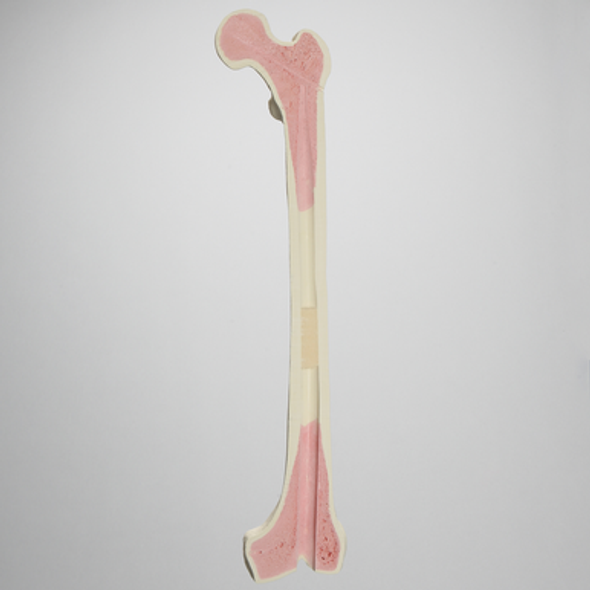 Stryker Femur for Exeter Plug and Stem