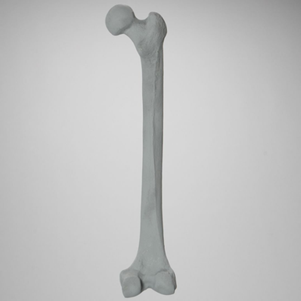 Femur, Radiopaque, Right