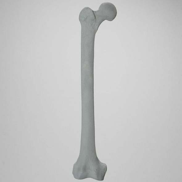 Femur, Radiopaque, Right