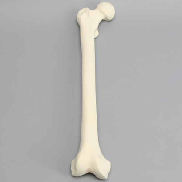 Femur, 16 mm Canal, Foam Cortical, Right