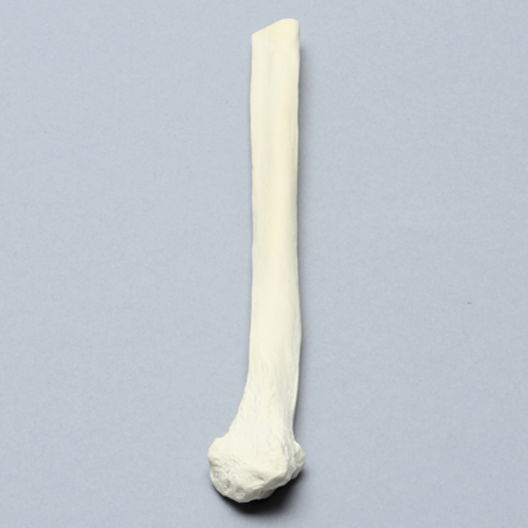 Fibula, Distal, Solid Foam, Left