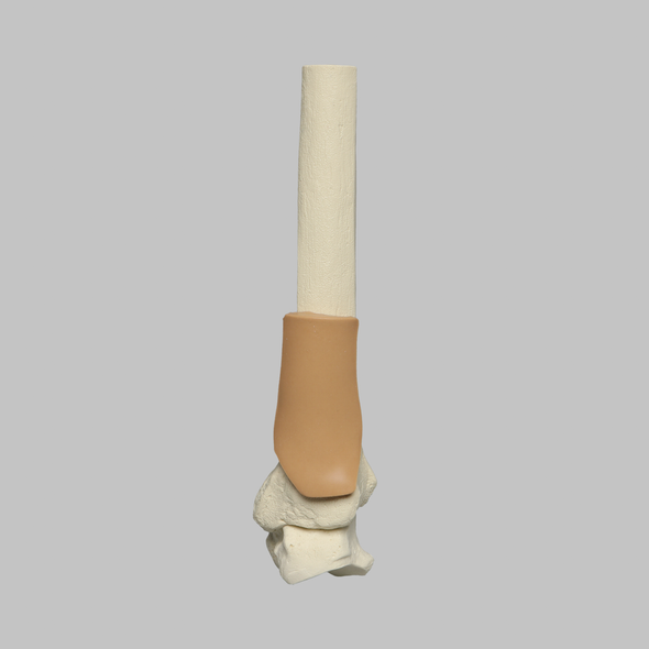 Tibia with Skin Patch and Talus Tibia with Skin Patch and Talus
