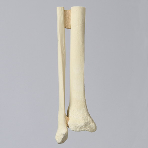 Tibia and Fibula, Distal, Solid Foam, Left