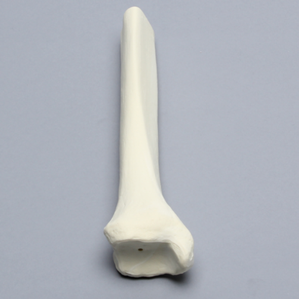 Tibia, Distal, Solid Foam, Right
