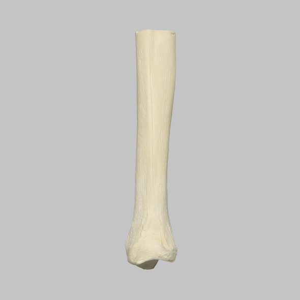 Tibia, Distal, Solid Foam, Right