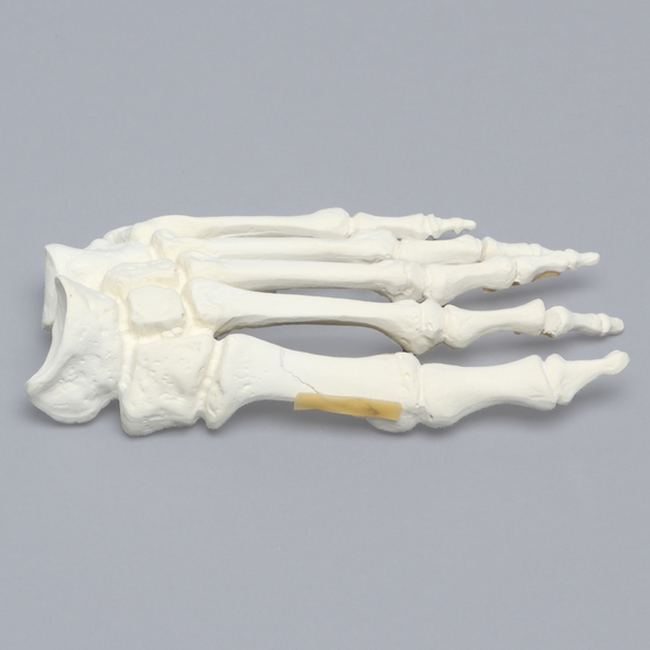 Foot with Chevron Cut and Articulation, Solid Foam, Left
