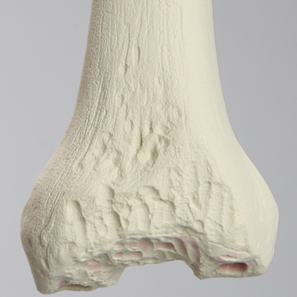 Femur with Revision Cuts, Foam Cortical, Left