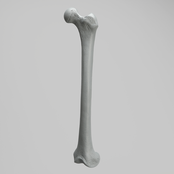 Femur, Radiopaque, Left, Medium